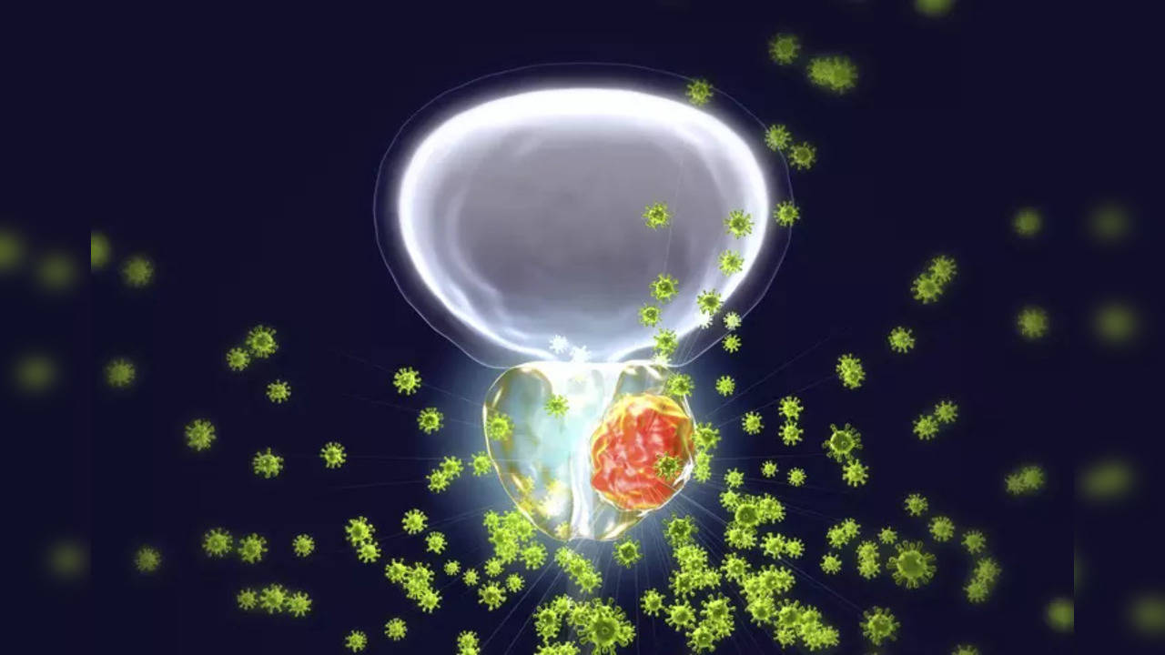 A man in his 50s diagnosed with metastatic hormone-sensitive prostate cancer was administered androgen deprivation therapy and abiraterone acetate/prednisone which resulted in an uncontrolled ‘Irish brogue’ accent despite no Irish background – symptoms that are consistent with foreign accent syndrome (FAS).