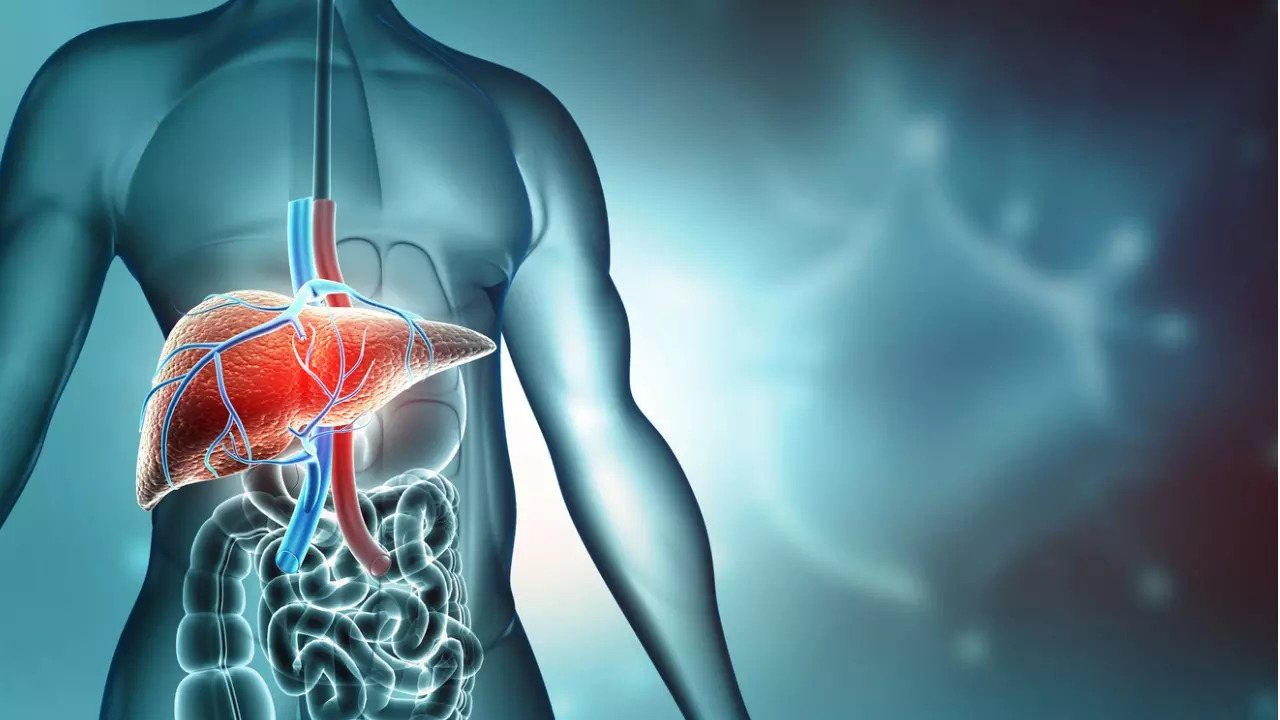 Liver Cirrhosis