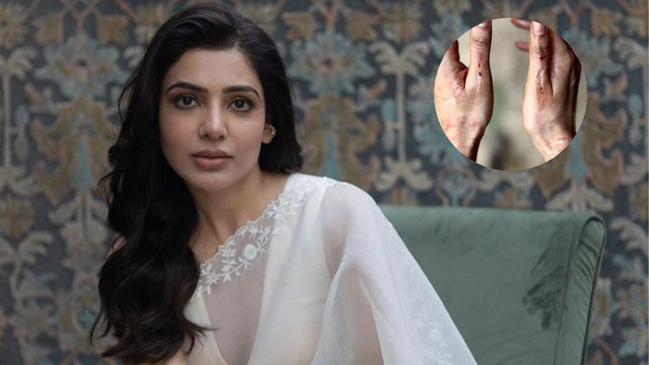 Samantha Ruth Prabhu shares pic of badly BRUSIED hands after shooting action scenes. See inside