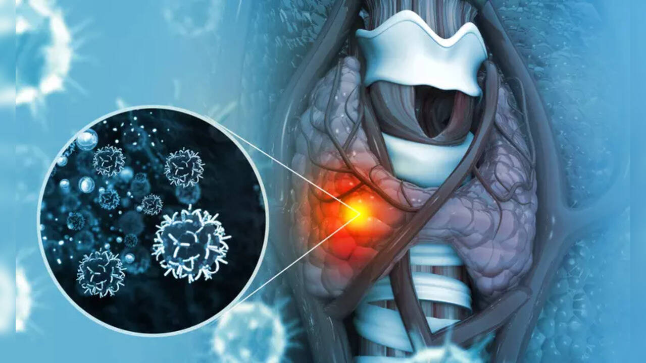 Throat cancer Coffee addiction saves 58YO man, helps him discover