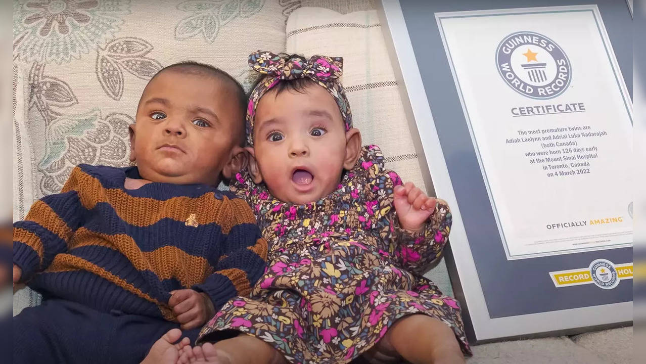 World s most premature twins who docs believed had 0 chance of