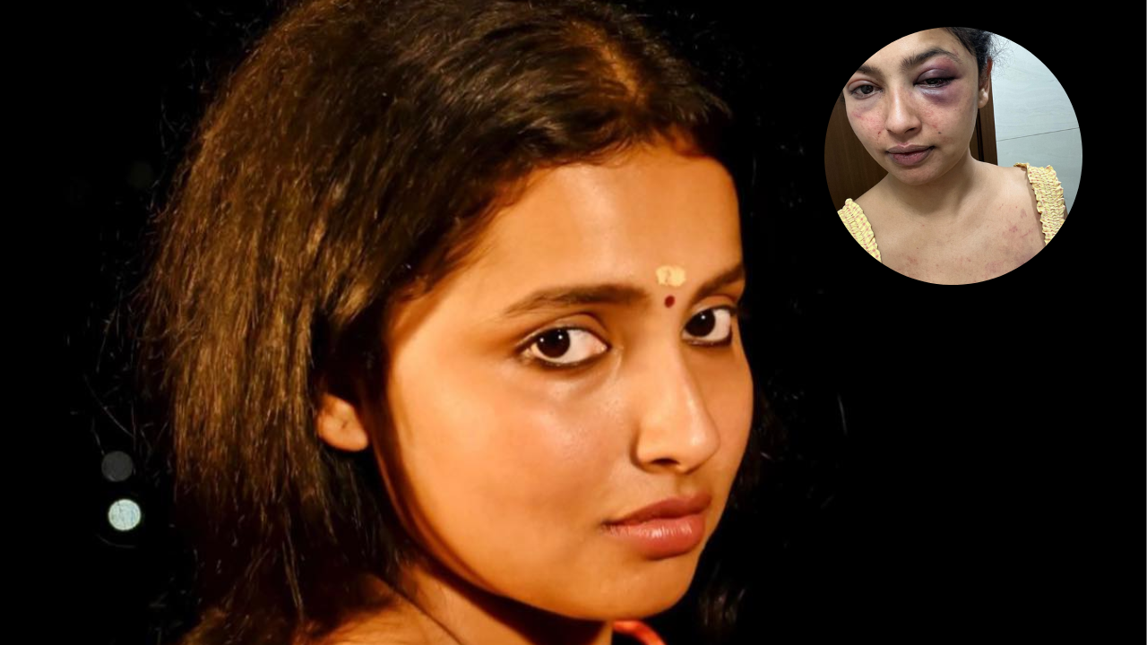 Shocking! Malayalam actress Anicka Vikhraman assaulted by boyfriend, reveals he 'went on a punching spree'