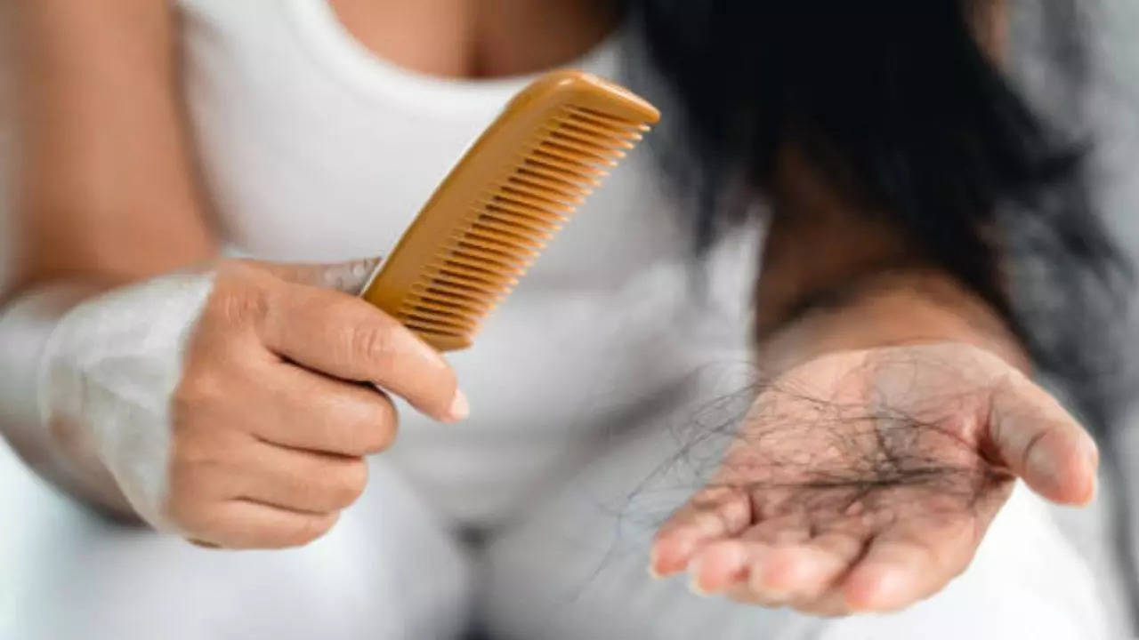 Hair fall (Representative Image)