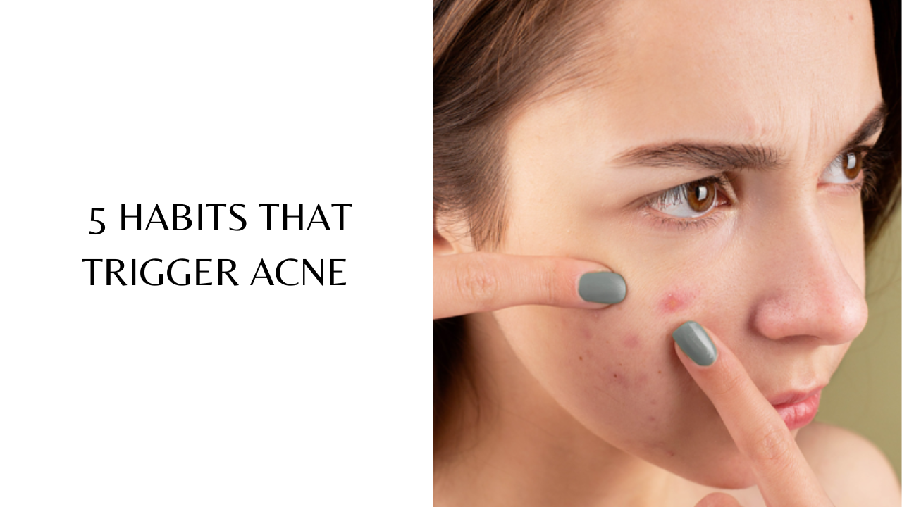 5 Habits that trigger acne. Pic Credit: Pexels