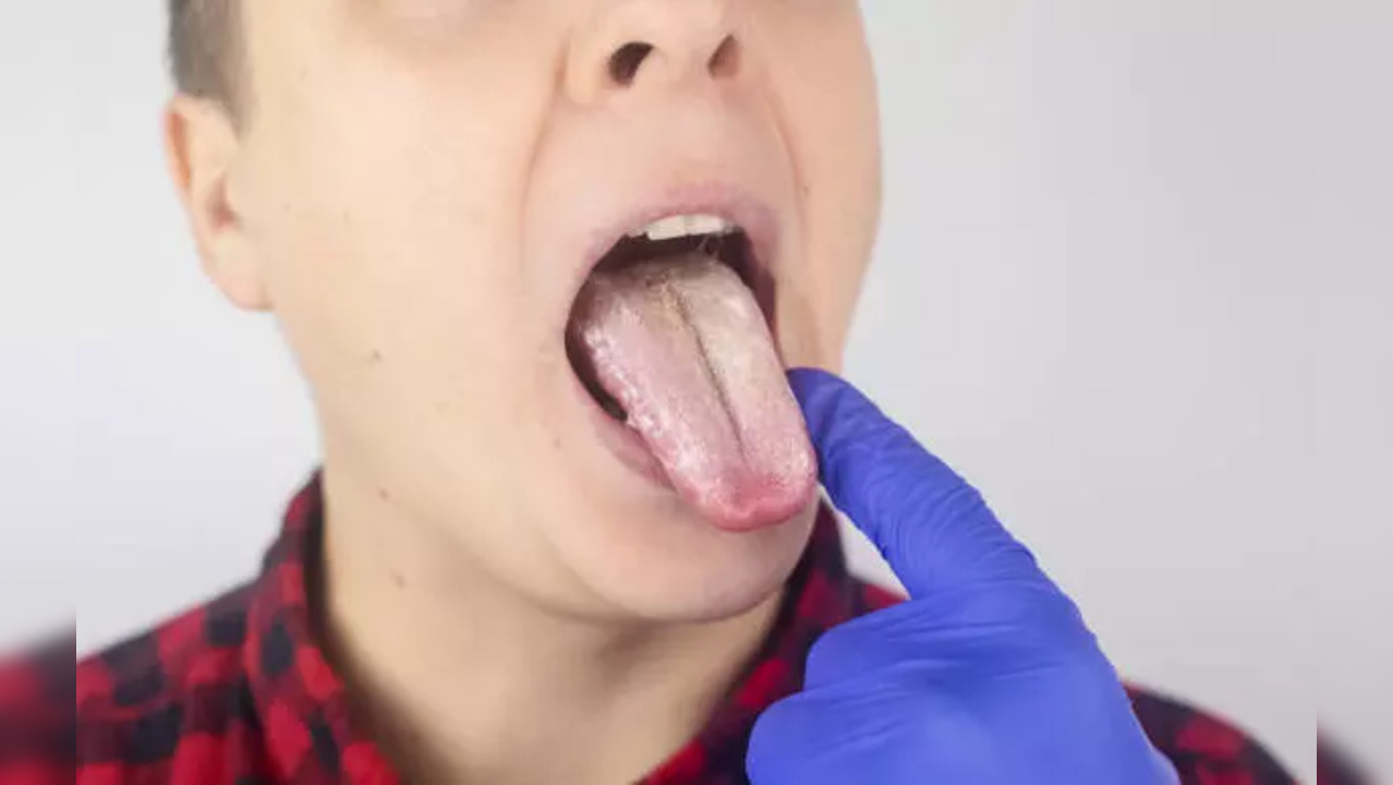 Tongue